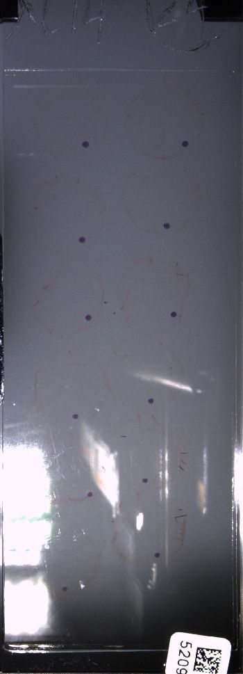 Media type: image; Special Collections 4011   shows specimen_part histological serial section;